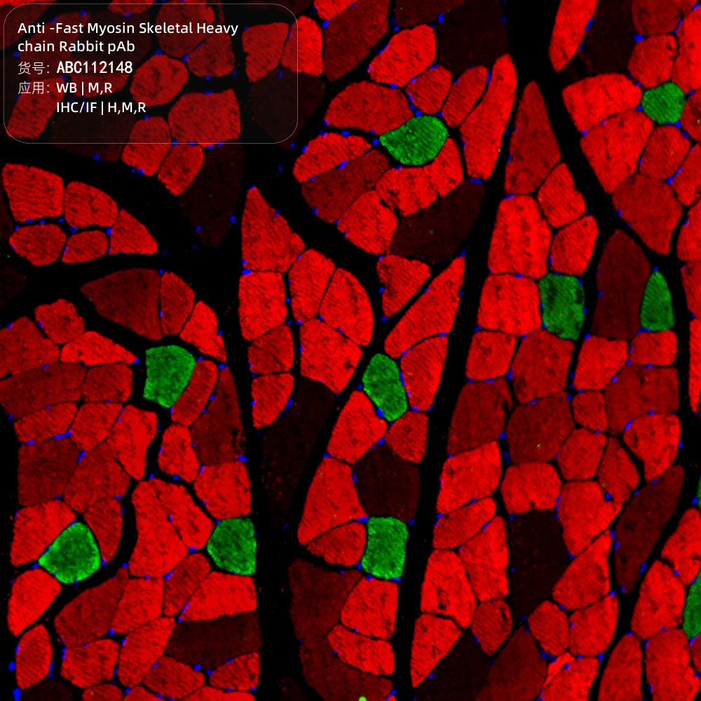 Anti -Fast Myosin Skeletal Heavy chain Rabbit pAb （ABC112148）