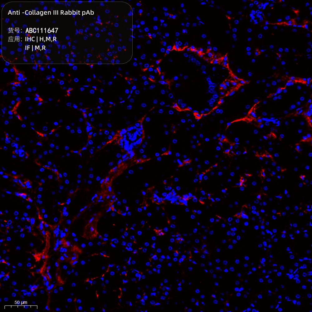 Anti -Collagen III Rabbit pAb （ABC111647）