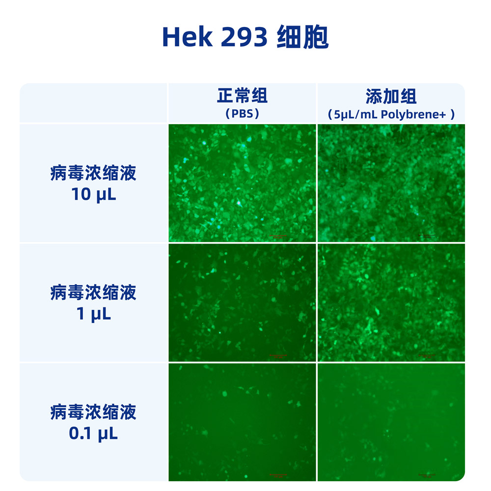 聚凝胺（10mg/ml） （ABC1821）