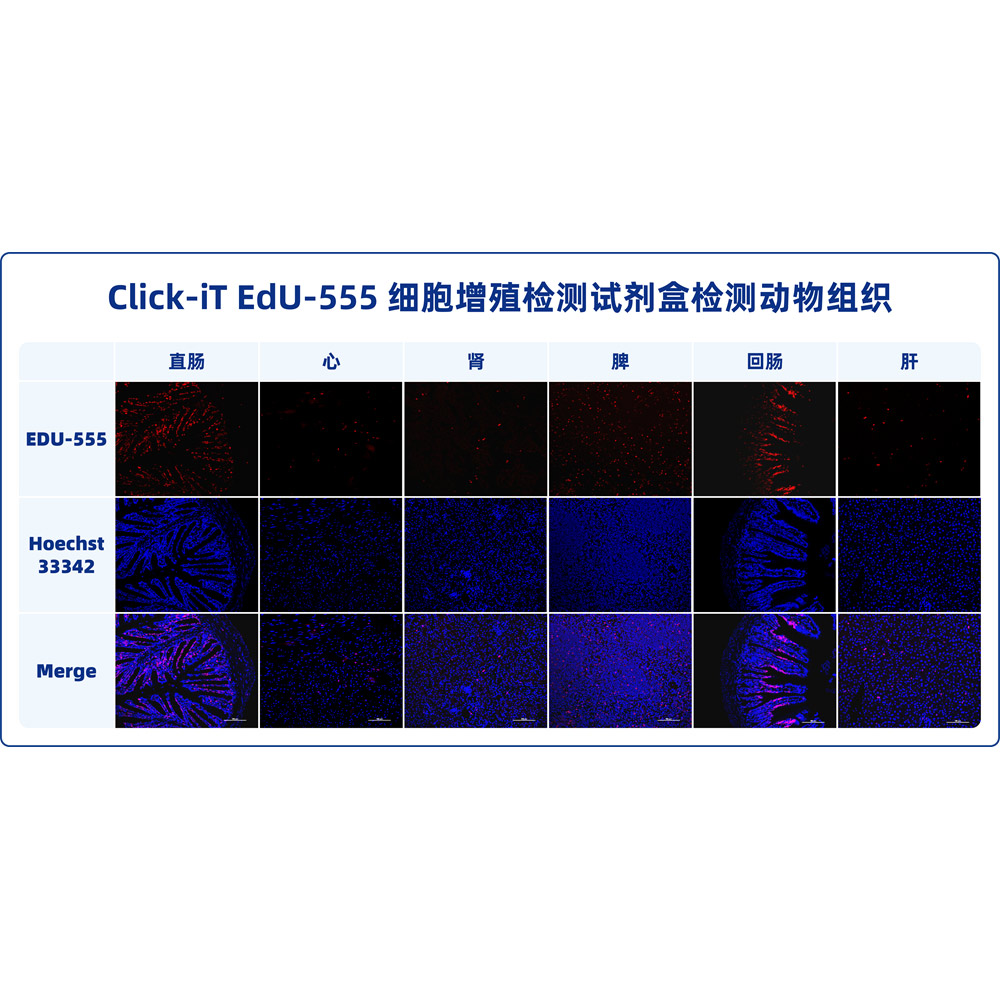 Click-iT EdU-555細(xì)胞增殖檢測(cè)試劑盒 （ABC1620）