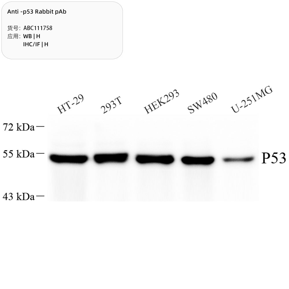 Anti -p53 Rabbit pAb （ABC111758）