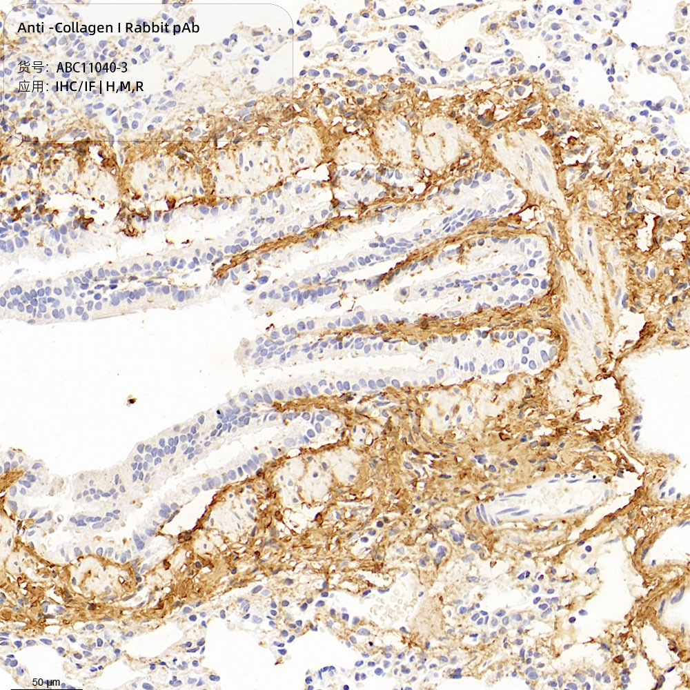 Anti -Collagen I Rabbit pAb （ABC11040-3）