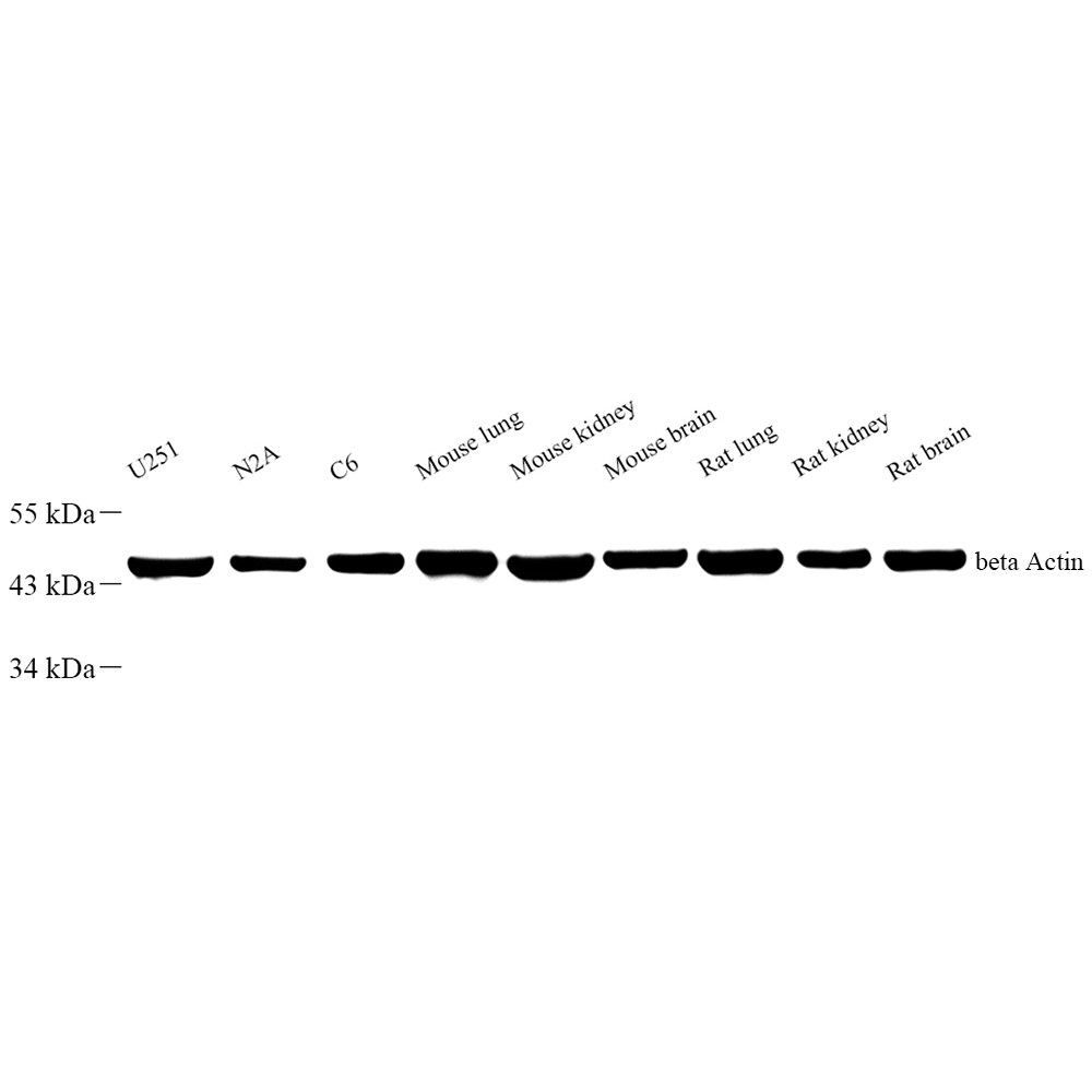 Anti -beta Actin Rabbit pAb （ABC11019）