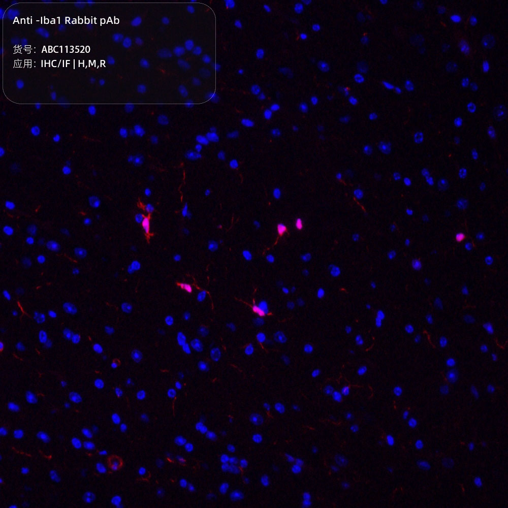 Anti -Iba1 Rabbit pAb （ABC113520）