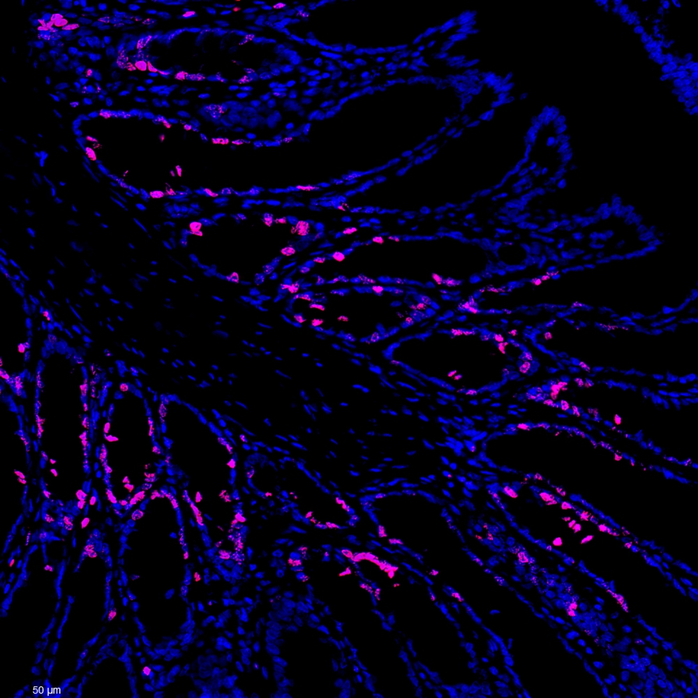 Anti -Ki67 Mouse mAb （ABC121159）