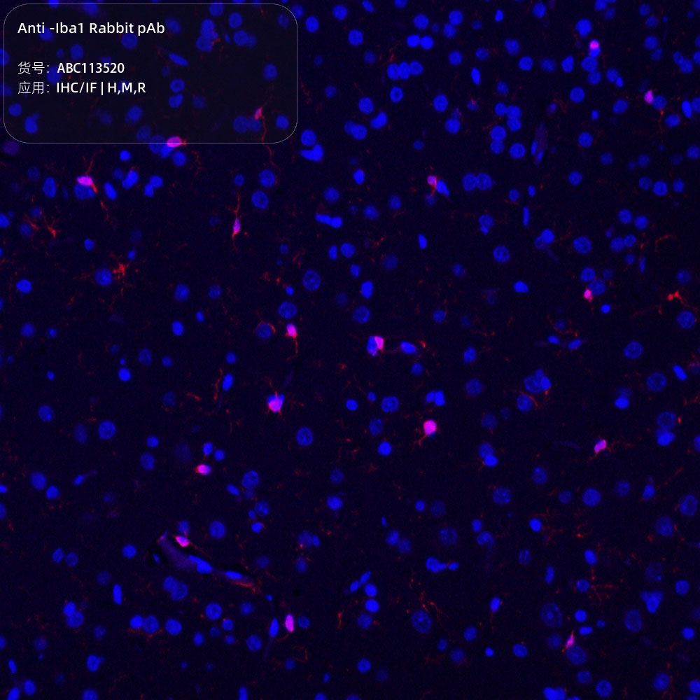 Anti -Iba1 Rabbit pAb （ABC113520）