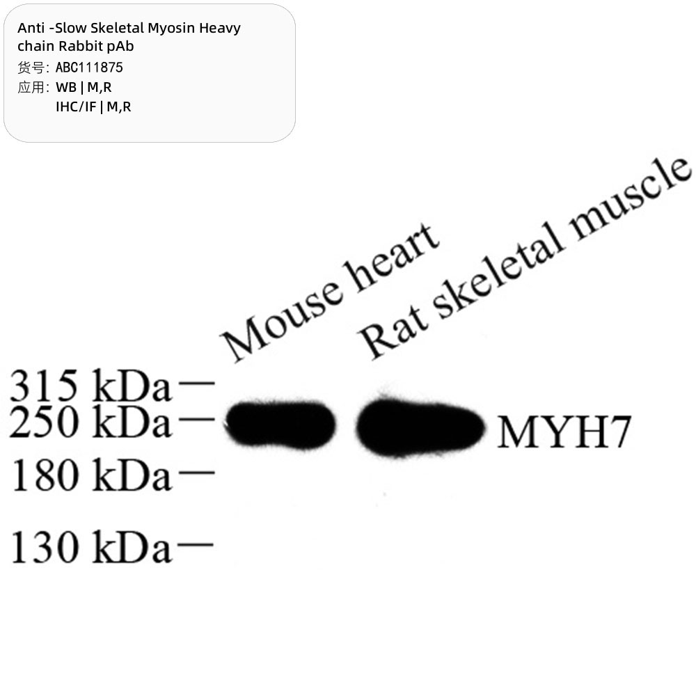 Anti -Slow Skeletal Myosin Heavy chain Rabbit pAb （ABC111875）